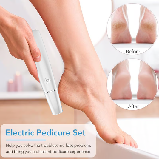 🔥Hot Sale - 50% OFF🔥Electric Feet Callus Remover⚡--Buy 2Get 10% Off