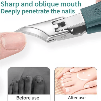 Buy one get one free🔥Eagle Beak Angled Nail Clippers 3-Piece Set